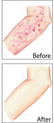 TriDerma MD Intense Fast Healing Multi-Purpose Skin Cream